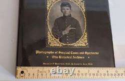 1996 Photographic Atlas of Civil War Injuries Bengtson Kuz 1st Edition