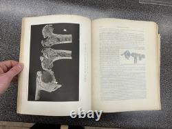 The Medical and Surgical History of the War of the Rebellion, Pt 3, Vol II, 1883