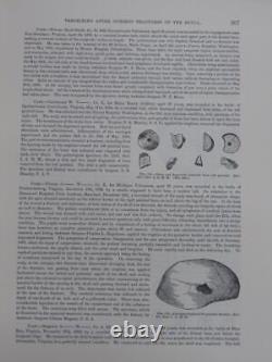 Histoire médicale et chirurgicale de la guerre civile, ensemble complet de 15 volumes et index