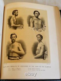 L'histoire Médicale Et Surgique De La Guerre Civile Partie 2 Vol II Illustrée 1877