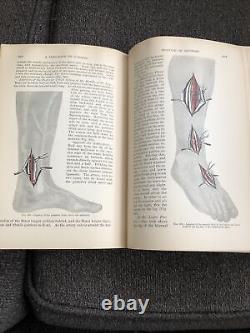 Rare 1887 1ère édition du livre de chirurgie de John A. Wyeth M. D., chirurgien de la guerre civile